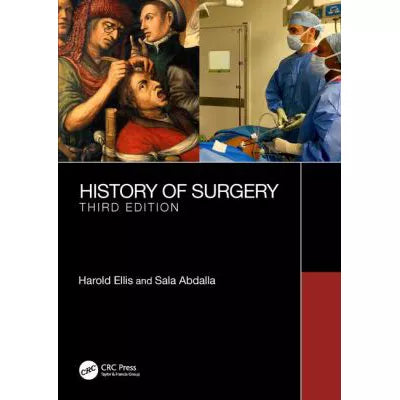 History of Surgery